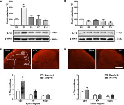 Spinal Interleukin-1β Inhibits Astrocyte Cytochrome P450c17 Expression Which Controls the Development of Mechanical Allodynia in a Mouse Model of Neuropathic Pain